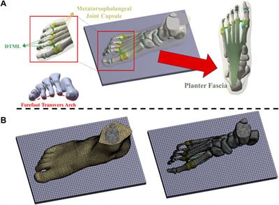 Effect of forefoot transverse arch stiffness on foot biomechanical response--based on finite element method